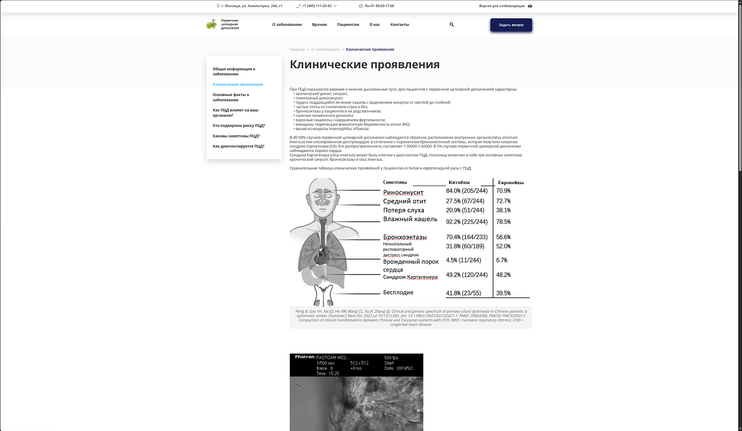 Социальный проект Первичная цилиарная дискинезия